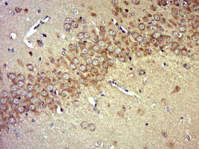 Pro-Neuregulin 1 Antibody in Immunohistochemistry (Paraffin) (IHC (P))