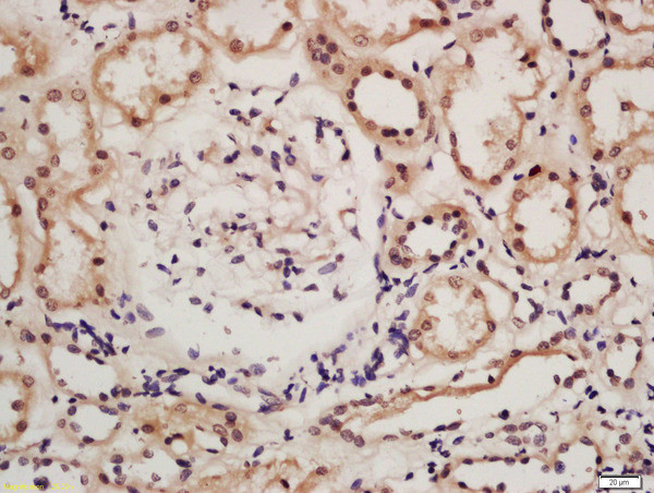 IRF9 Antibody in Immunohistochemistry (Paraffin) (IHC (P))