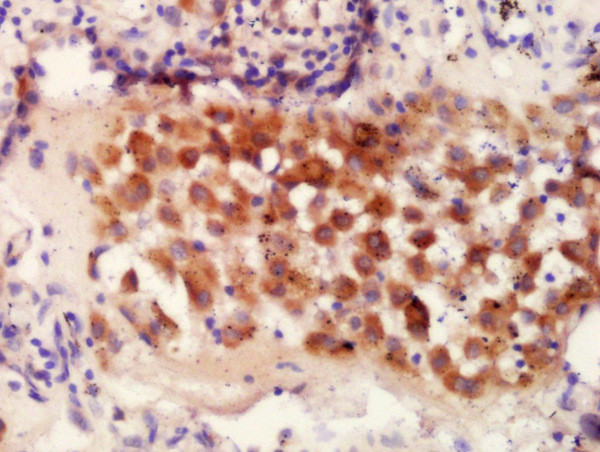 IRF9 Antibody in Immunohistochemistry (Paraffin) (IHC (P))