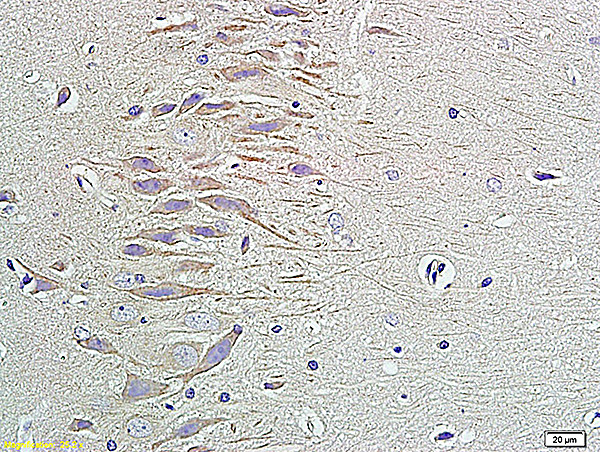 Pro-NRG1 Antibody in Immunohistochemistry (Paraffin) (IHC (P))