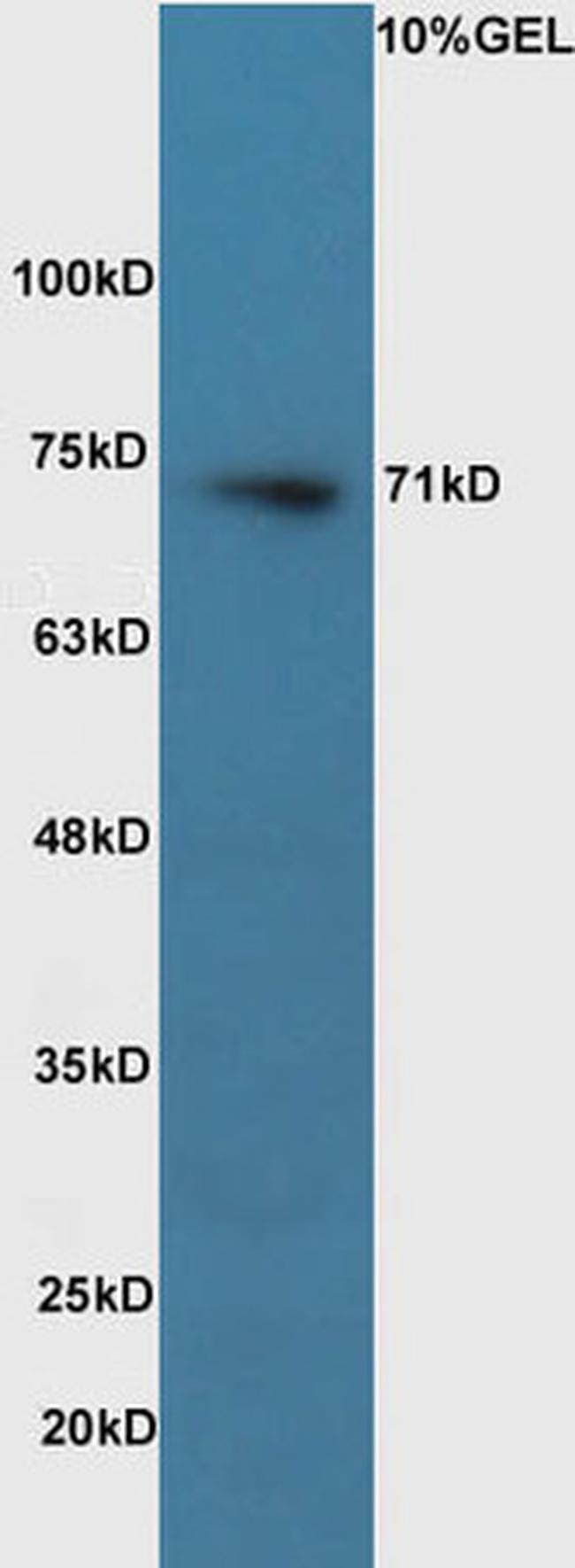 Pro-NRG1 Antibody in Western Blot (WB)