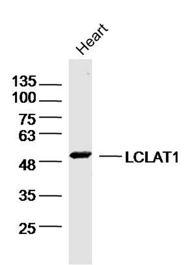 LCLAT1 Antibody in Western Blot (WB)