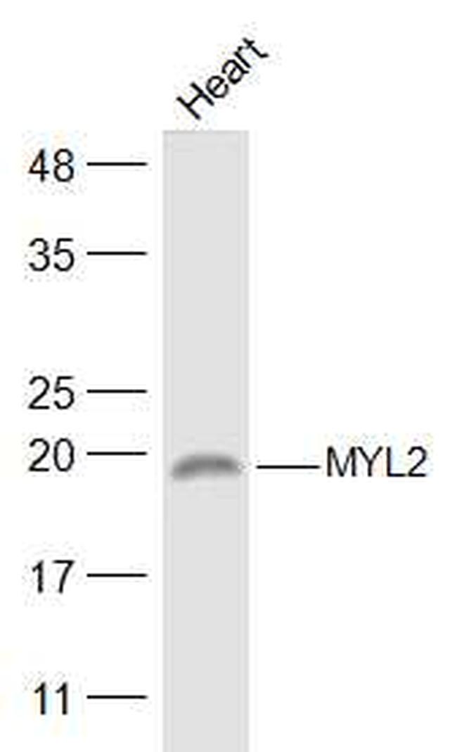 MYL2 Antibody in Western Blot (WB)