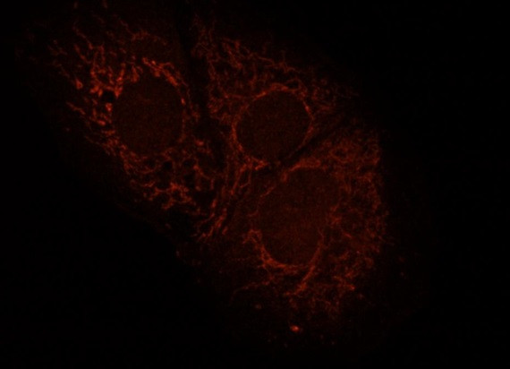 Mitofilin/IMMT Antibody in Immunocytochemistry (ICC/IF)