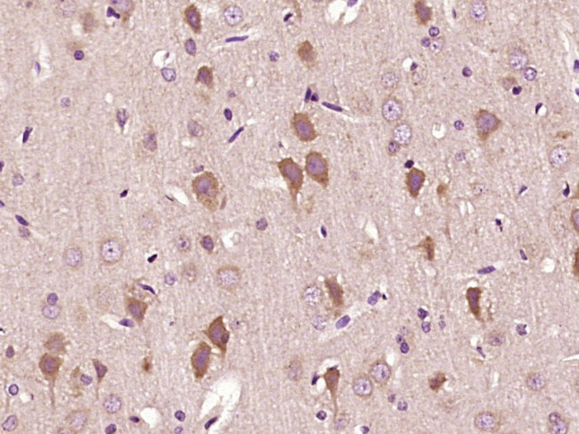 Mitofilin/IMMT Antibody in Immunohistochemistry (Paraffin) (IHC (P))