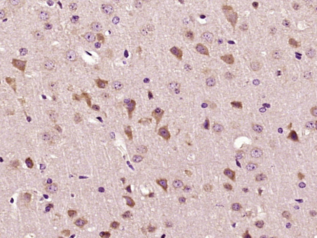 Mitofilin/IMMT Antibody in Immunohistochemistry (Paraffin) (IHC (P))