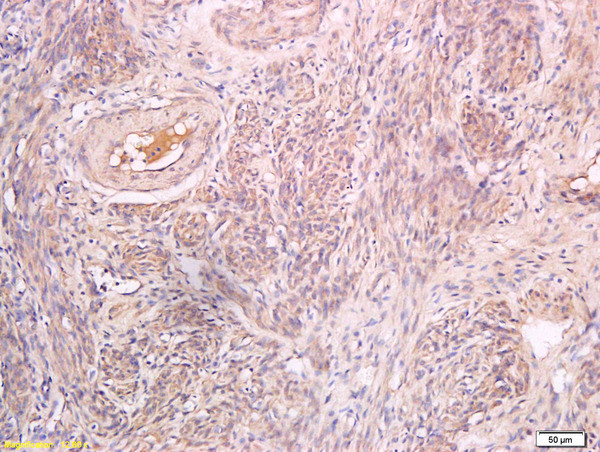 Pro-Inhibin beta B Antibody in Immunohistochemistry (Paraffin) (IHC (P))