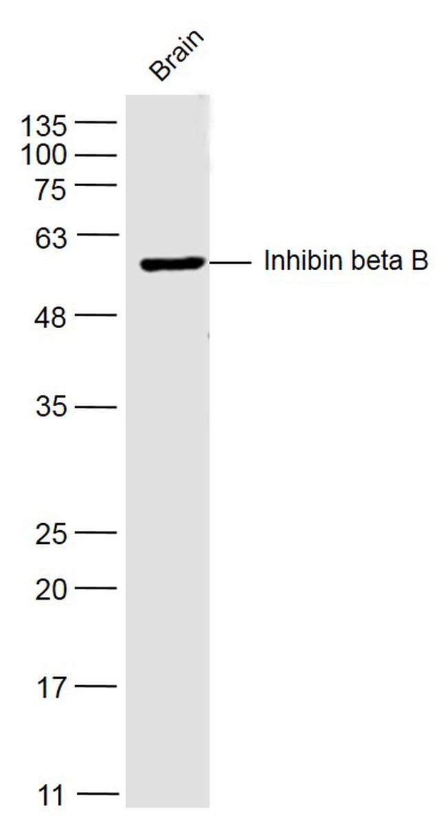 Pro-Inhibin beta B Antibody in Western Blot (WB)