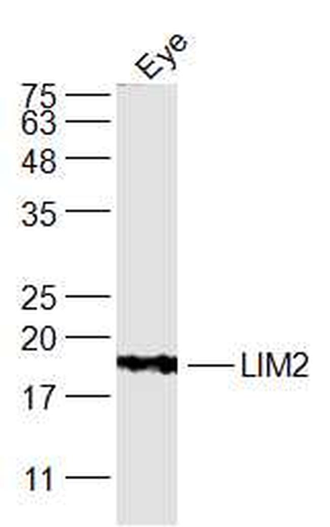LIM2 Antibody in Western Blot (WB)