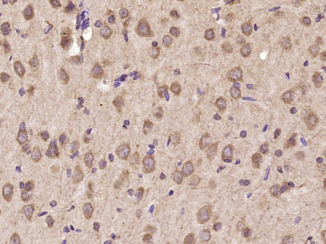 IL-11 Antibody in Immunohistochemistry (Paraffin) (IHC (P))