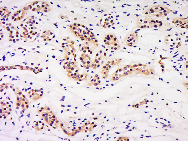 LIN9 Antibody in Immunohistochemistry (Paraffin) (IHC (P))