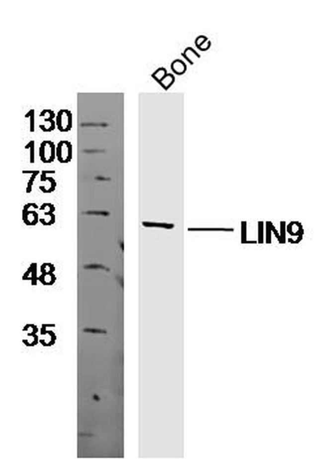 LIN9 Antibody in Western Blot (WB)