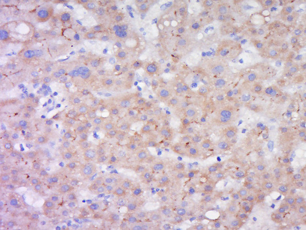 LIPC Antibody in Immunohistochemistry (Paraffin) (IHC (P))