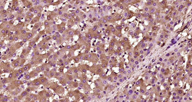 Plasminogen Antibody in Immunohistochemistry (Paraffin) (IHC (P))