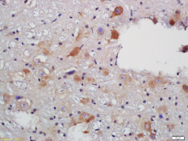 VAT Antibody in Immunohistochemistry (Paraffin) (IHC (P))