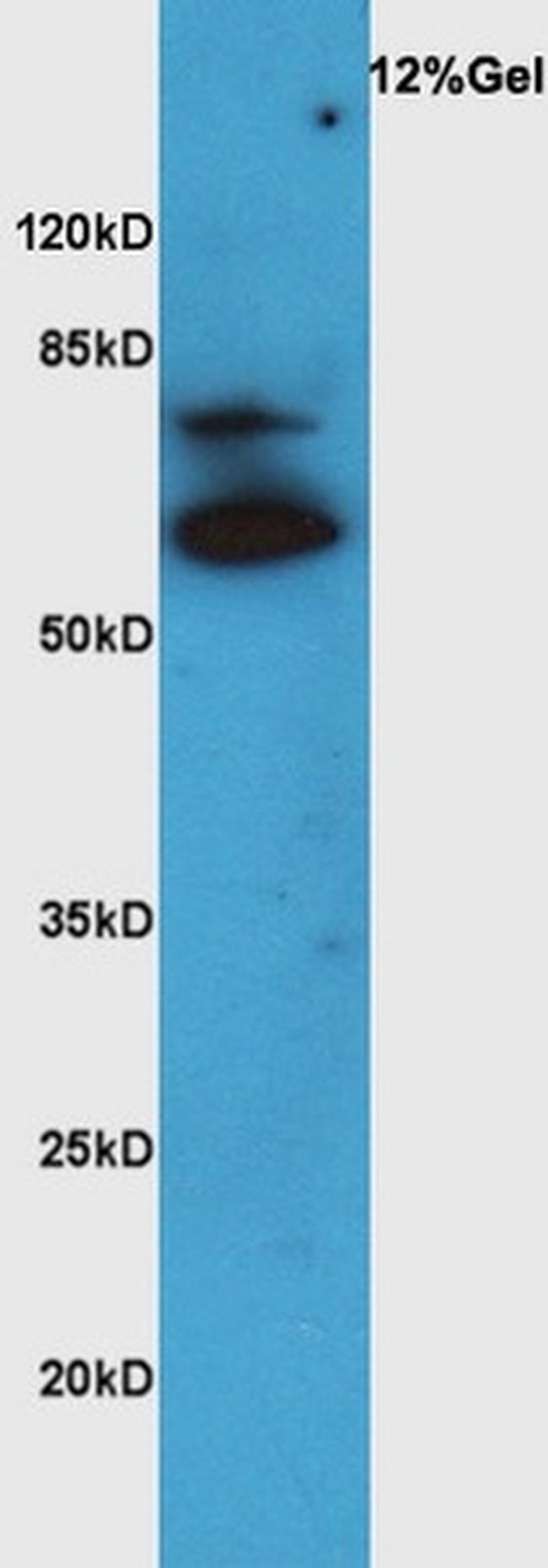 VAT Antibody in Western Blot (WB)