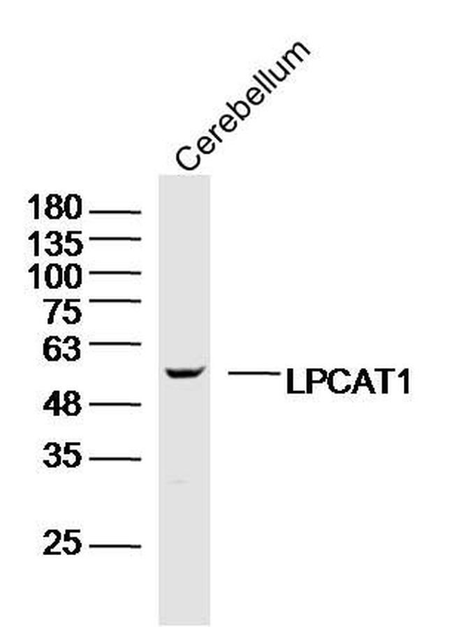 LPCAT1 Antibody in Western Blot (WB)