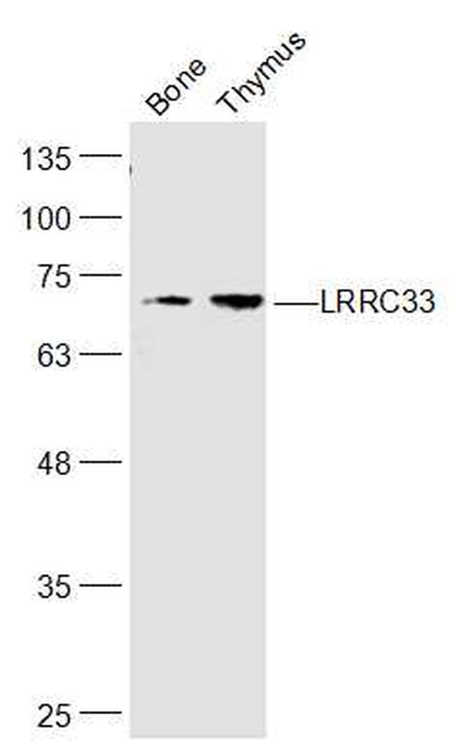 LRRC33 Antibody in Western Blot (WB)