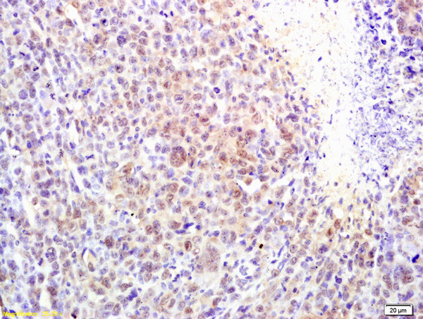 alpha MSH Antibody in Immunohistochemistry (Paraffin) (IHC (P))