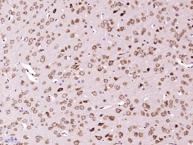 NR3C2/Mineralocorticoid receptor Antibody in Immunohistochemistry (Paraffin) (IHC (P))