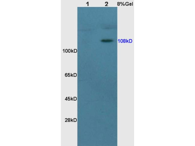 NR3C2/Mineralocorticoid receptor Antibody in Western Blot (WB)