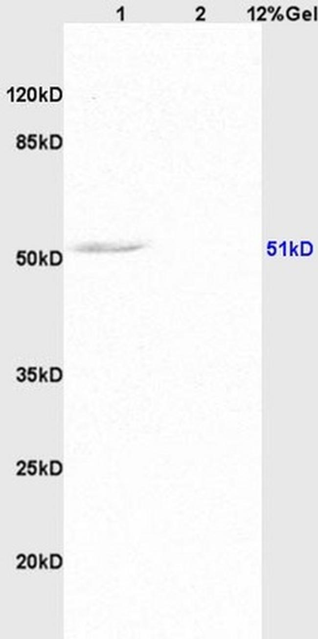 MMP-11 Antibody in Western Blot (WB)