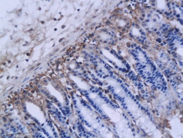 MMP-12 Antibody in Immunohistochemistry (Paraffin) (IHC (P))