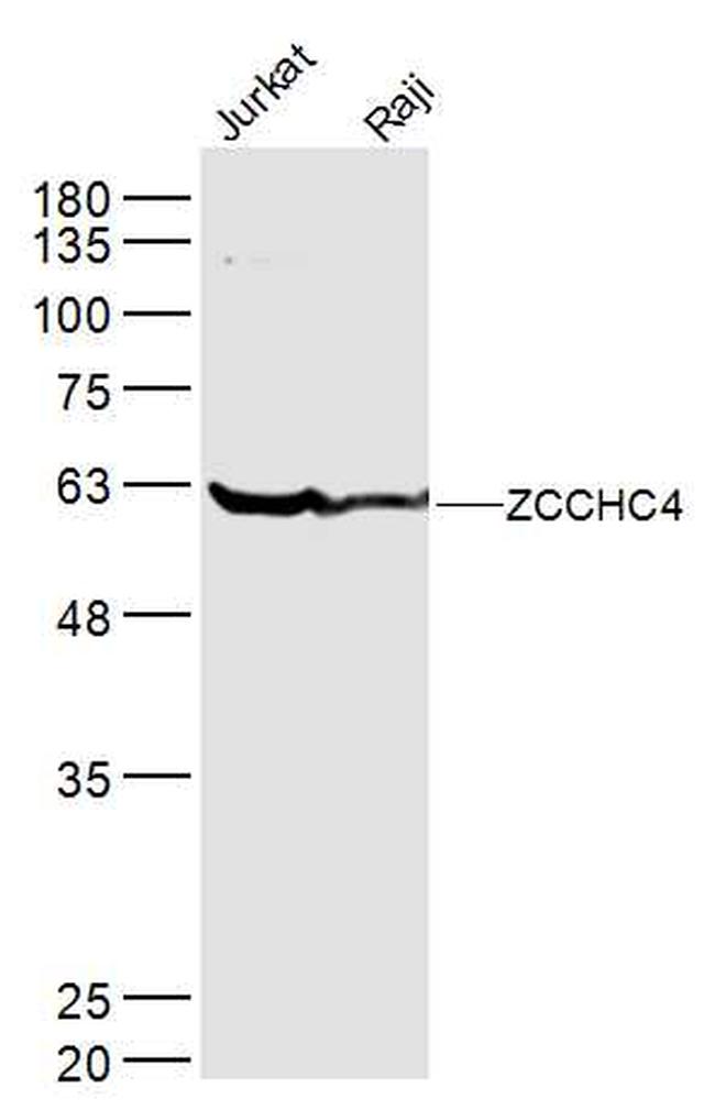 ZCCHC4 Antibody in Western Blot (WB)