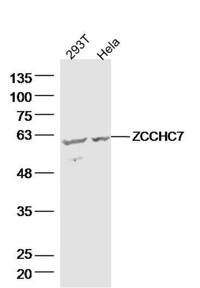 ZCCHC7 Antibody in Western Blot (WB)