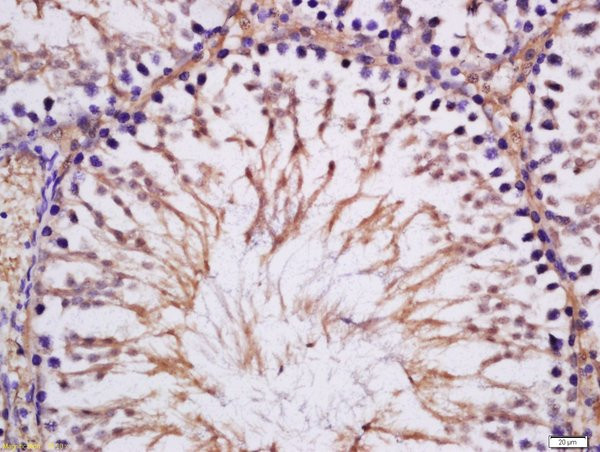 MAK Antibody in Immunohistochemistry (Paraffin) (IHC (P))