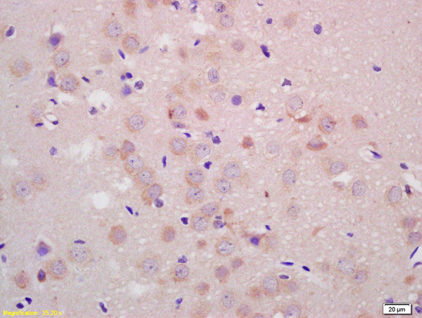 PARK2 Antibody in Immunohistochemistry (Paraffin) (IHC (P))