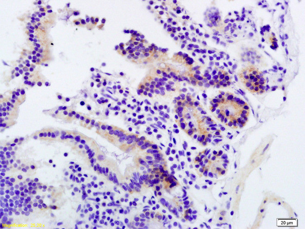 PD-1/CD279 Antibody in Immunohistochemistry (Paraffin) (IHC (P))