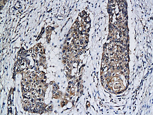 PDL2/B7-DC Antibody in Immunohistochemistry (Paraffin) (IHC (P))