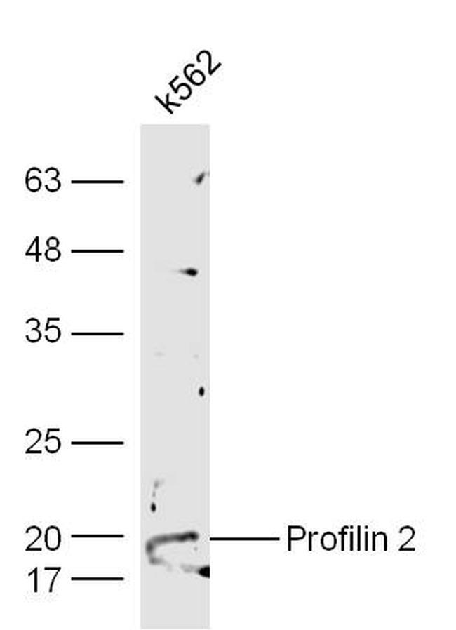 Profilin 2 Antibody in Western Blot (WB)