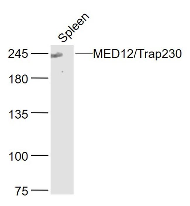 MED12/Trap230 Antibody in Western Blot (WB)