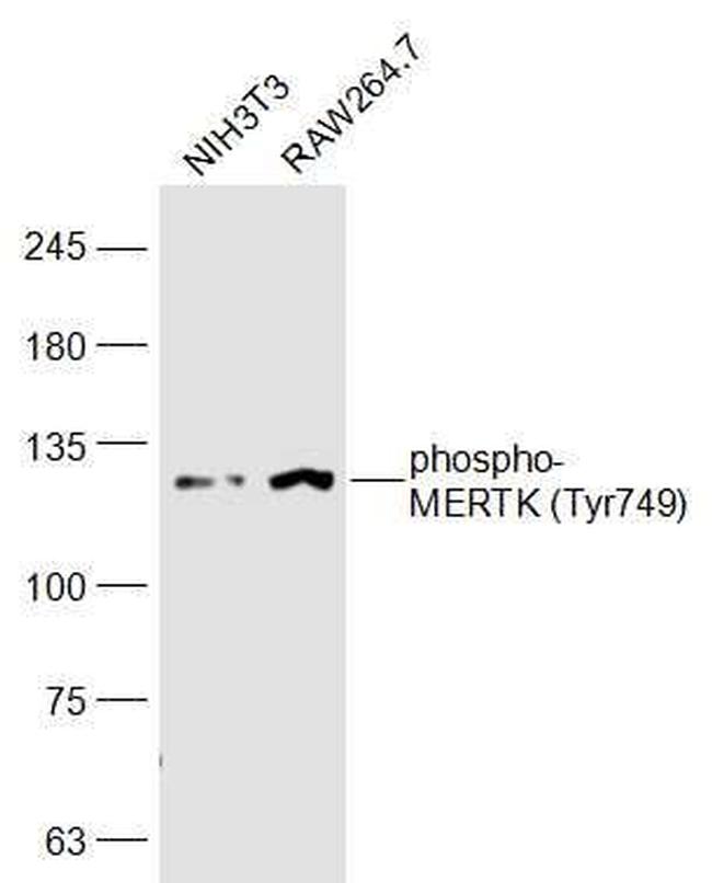 Phospho-MERTK (Tyr749) Antibody in Western Blot (WB)