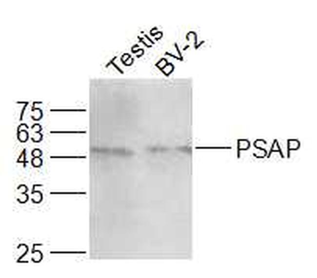 PSAP/PAP Antibody in Western Blot (WB)
