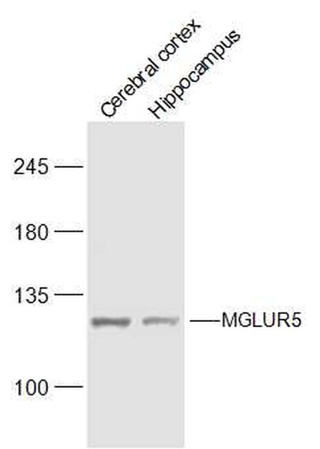 MGLUR5 Antibody in Western Blot (WB)