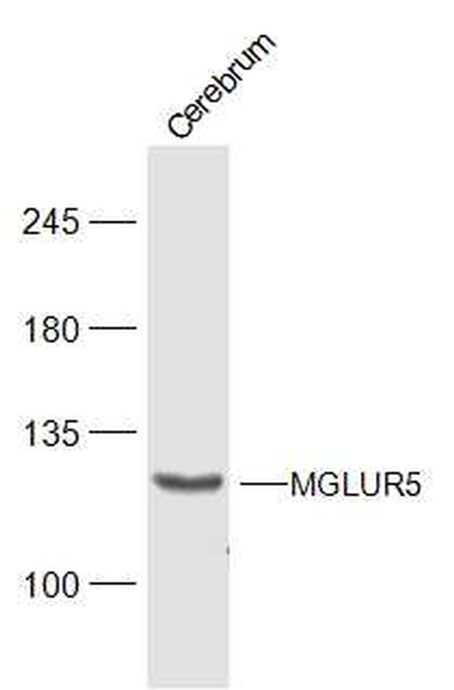 MGLUR5 Antibody in Western Blot (WB)