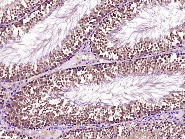 Securin/PTTG Antibody in Immunohistochemistry (Paraffin) (IHC (P))