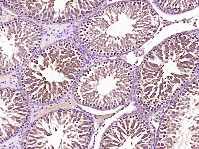 Securin/PTTG Antibody in Immunohistochemistry (Paraffin) (IHC (P))