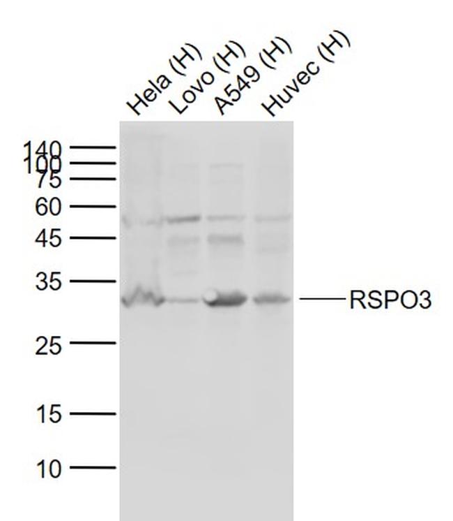 RSPO3 Antibody in Western Blot (WB)