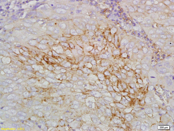 STEAP1 Antibody in Immunohistochemistry (Paraffin) (IHC (P))