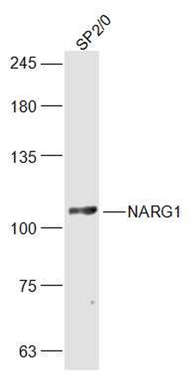 NARG1 Antibody in Western Blot (WB)