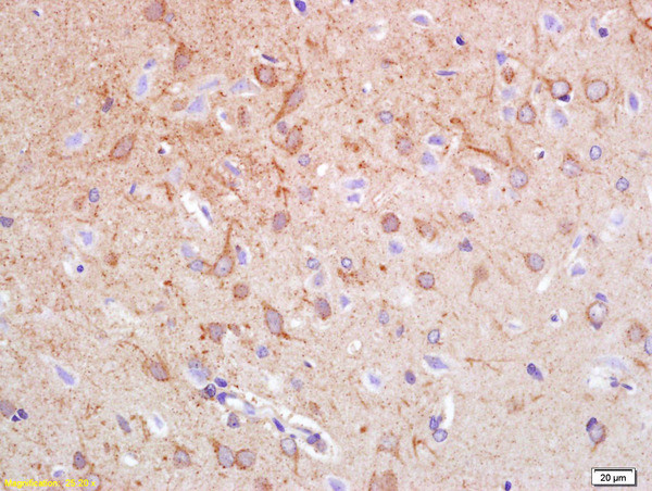 Synphilin 1 Antibody in Immunohistochemistry (Paraffin) (IHC (P))