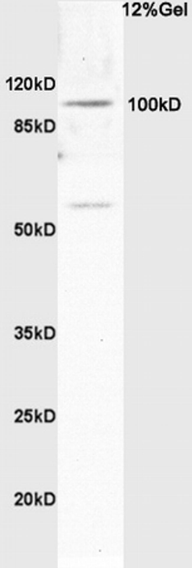 Synphilin 1 Antibody in Western Blot (WB)