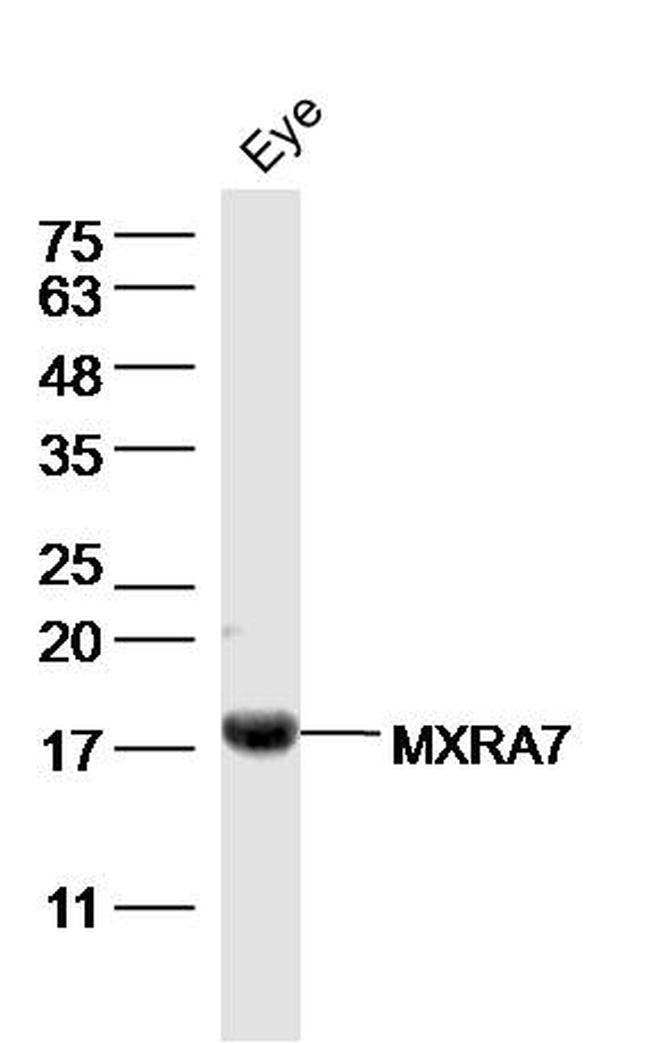 MXRA7 Antibody in Western Blot (WB)