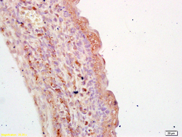 TGM3 Antibody in Immunohistochemistry (Paraffin) (IHC (P))