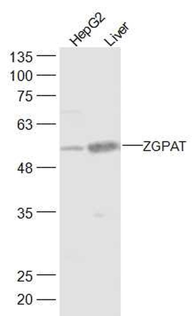 ZGPAT Antibody in Western Blot (WB)