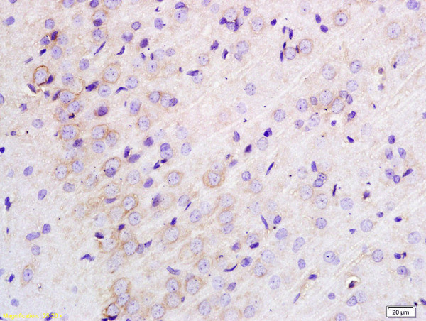 TLR1 Antibody in Immunohistochemistry (Paraffin) (IHC (P))